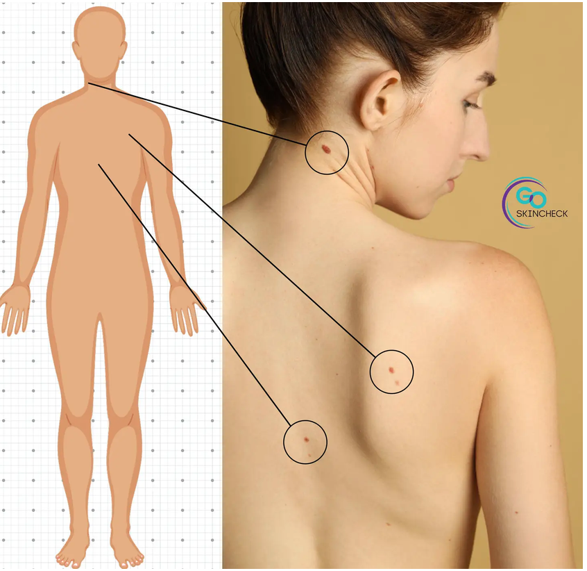 go-skin-check