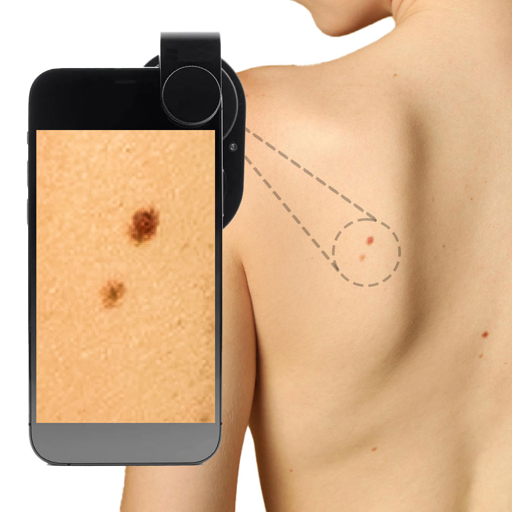 placeholder image-sq