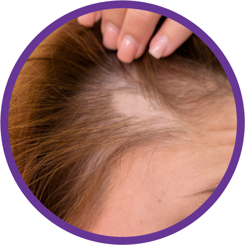 placeholder image-sq