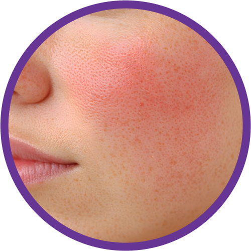 placeholder image-sq